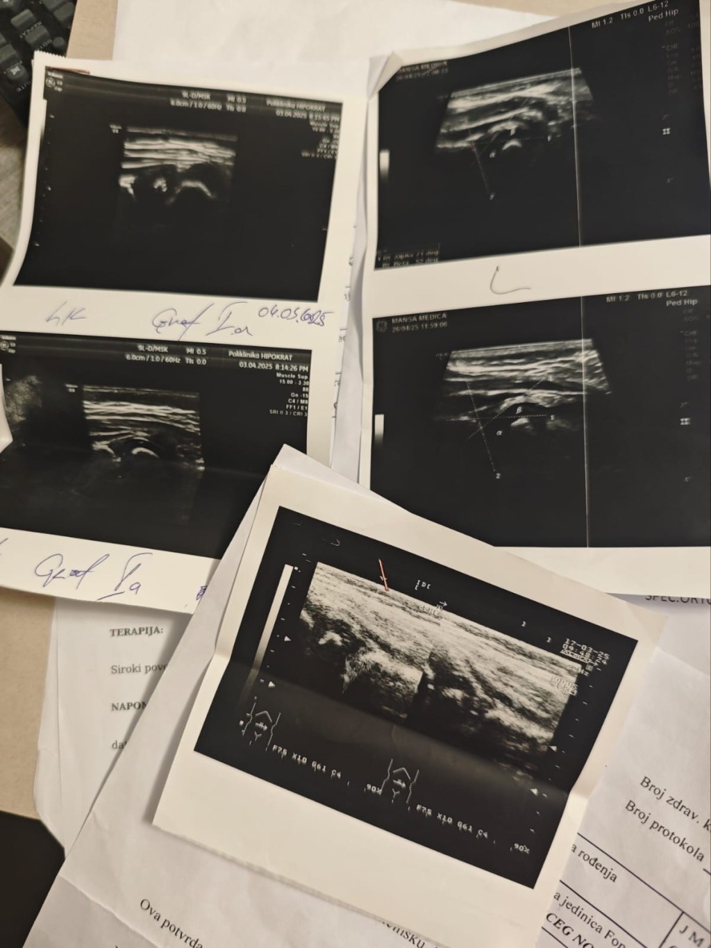 Da li su kukovi u&nbsp;redu?