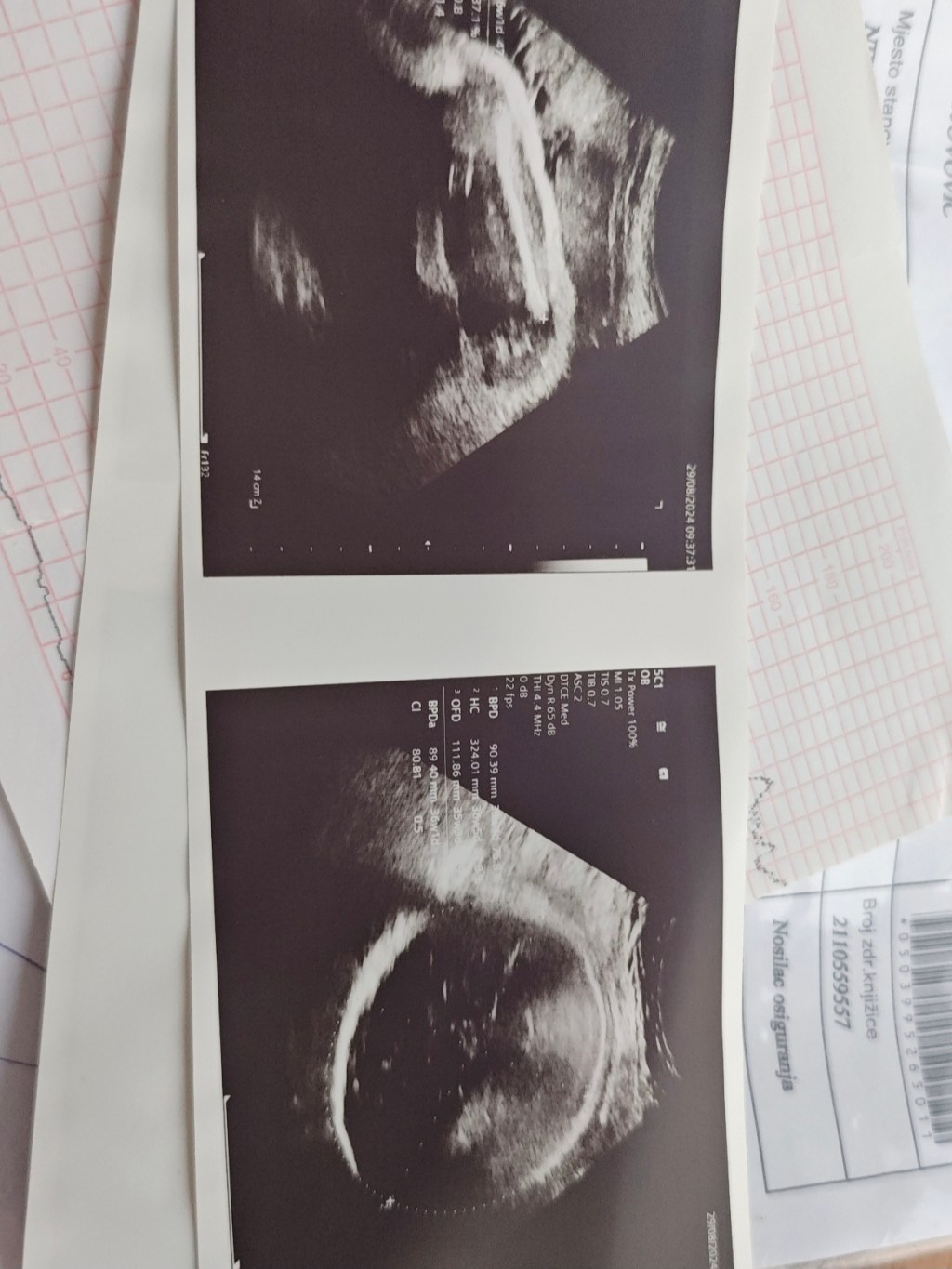 Trudnoća pod lupom: šta sve otkrivaju prenatalni&nbsp;testovi?